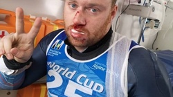 Паралимпиец из США получил травму на сахалинском этапе Кубка мира