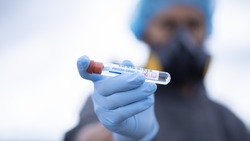 СМИ намекнули на искусственное создание коронавируса на фоне страха ВОЗ перед новой эпидемией