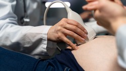 Законопроект о выводе абортов из услуг частных клиник внесли в Госдуму