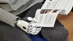 Бесплатный бионический протез кисти с микропроцессором получила жительница Сахалина