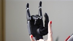 Новейший бионический протез руки из Сколково выдали жителю Южно-Сахалинска